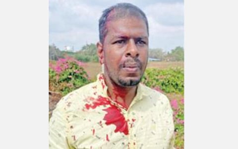 காயமடைந்த காங். வேட்பாளரின் ஆதரவாளர் ஜேசுராஜ்.