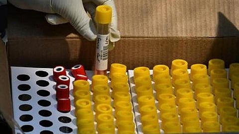 மார்ச் 4: தமிழக நிலவரம்; மாவட்ட வாரியாக கரோனா தொற்றுப் பட்டியல்