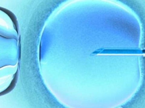 பிரதிநிதித்துவப் படம்