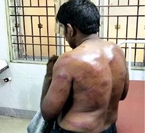 விருத்தாசலம் அரசு மருத்துவ மனையில் சிகிச்சை பெறும் அந்தோணிடேவிட்.