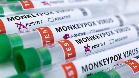 குரங்கு அம்மை நோய் | தடுப்பூசி கண்டுபிடிக்க விருப்பத்தை தெரிவிக்கலாம் - நிறுவனங்களுக்கு மத்திய அரசு அழைப்பு