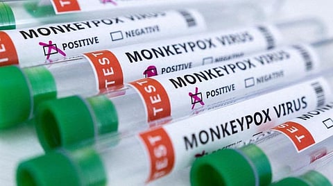 குரங்கு அம்மை பரவல் - சுகாதார அவசரநிலையை அறிவித்தது அமெரிக்கா