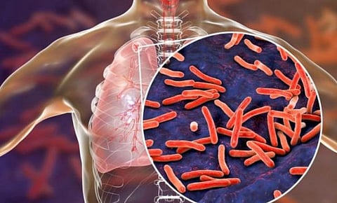 ஆசிரியர்கள் மனது வைத்தால் 2025-ல் காசநோயற்ற இந்தியா