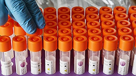 முடிவுக்கு வருகிறதா கோவிட்-19?