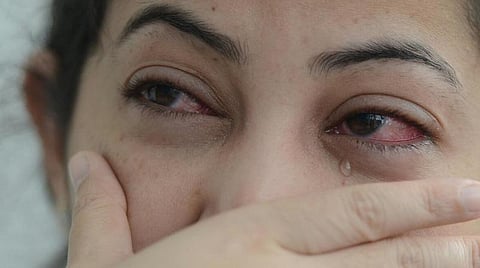 பிரதிநிதித்துவப் படம்