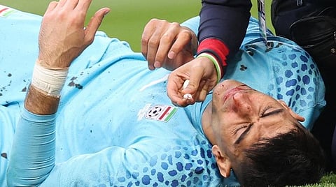 ஈரான் கோல் கீப்பர் அலிரேசா