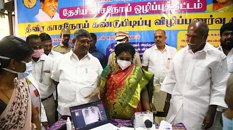 புதுச்சேரியில் வீடு வீடாக சென்று காசநோய் கணக்கெடுப்பு நடத்தும் பணி தொடக்கம்
