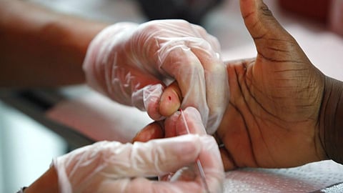 பிரதிநிதித்துவப் படம்