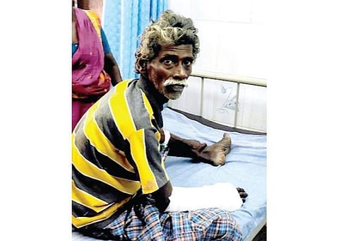 காயமடைந்த ஆறுமுகம்