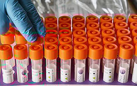 தமிழகத்தில் புதிதாக 329 பேருக்கு கரோனா பாதிப்பு