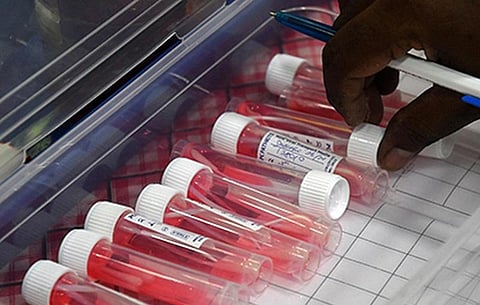 இந்தியாவில் புதிதாக 12,591 பேருக்கு கோவிட் தொற்று: நேற்றைவிட 20% அதிகம்