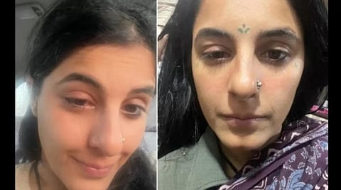 படப்பிடிப்பில் விபத்து: நடிகை இஷா தல்வார் காயம்