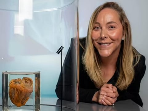 தன் இதயத்தின் அருகில் ஜெனிஃபர்