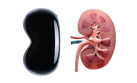 இணைய கலாட்டா: இரண்டு கிட்னி போதாது