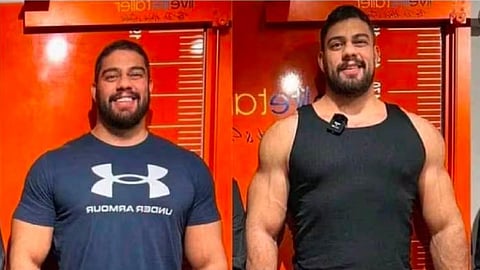 அறுவை சிகிச்சைக்கு முன்பும் பின்னரும் பிரையன் சான்செஸ்