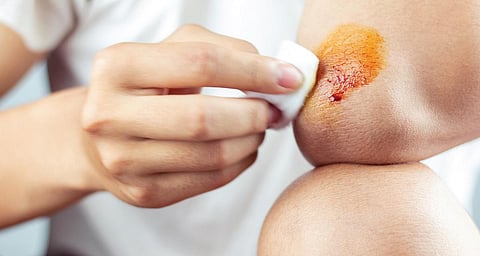 மாயம் செய்யும் மத்தன் எண்ணெய்