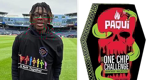 சமூக வலைதளத்தில் வைரலாக வேண்டி உலகின் காரமான சிப்ஸ் சாப்பிட்ட சிறுவன் உயிரிழப்பு