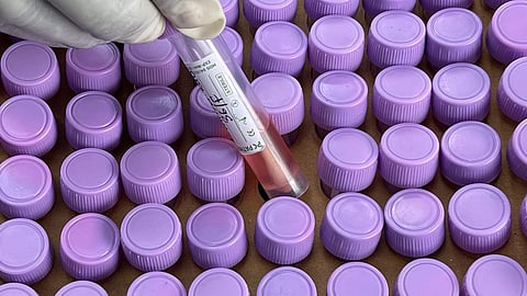 மாநில அரசுகள் கரோனா பரிசோதனையை அதிகப்படுத்த உத்தரவு