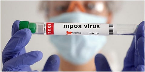 வெளிநாட்டில் இருந்து இந்தியா வந்த நபருக்கு குரங்கு அம்மை உறுதி: மத்திய அரசு தகவல்