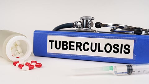 தமிழகத்தில் நடப்பாண்டில் புதிதாக 75,702 பேருக்கு காசநோய் பாதிப்பு