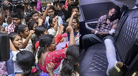 அண்ணா பல்கலை., வளாக பாலியல் வன்கொடுமை வழக்கில் கைதானவருக்கு எலும்பு முறிவு