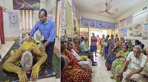 பக்கவாத நோயாளிகளுக்கு ‘பொடி திமிர்தல்’ சிகிச்சை - பவானி அரசு மருத்துவமனையில் அறிமுகம்