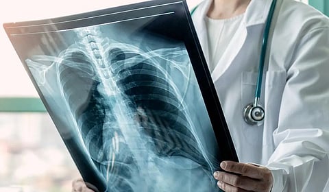 கோப்புப் படம் 