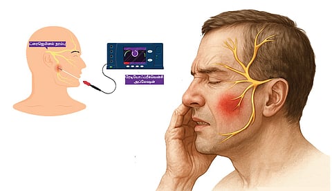 ட்ரைஜெமினல் நியூரால்ஜியா: அறுவை சிகிச்சை தான் தீர்வா?