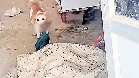 தெலங்கானாவில் பிணவறையில் சடலத்தை தின்ற தெரு நாய்கள்