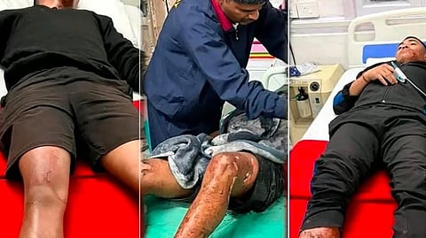 அசாமில் போலீஸ் முகாம் மீதான தாக்குதலில் 4 பேர் காயம்