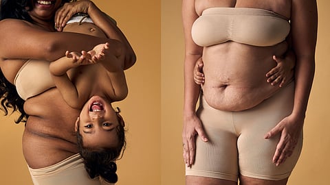 Photoseries 'Scars Are Beautiful' Aims To Shatter Taboos Surrounding Postpartum Bodies