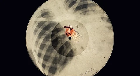 How Soviet Russia’s Bootleggers Saved Rock N’ Roll Using X-Ray Plates