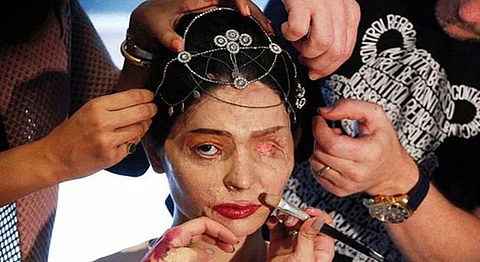 Acid Attack Survivor Reshma Hit The Catwalk Triumphantly At New York Fashion Week