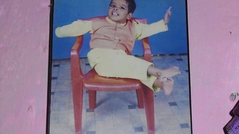 Guria was born deformed. Her father Chhatua blames the radiation from indiscriminate uranium mining and the tailings ponds for her death.
