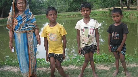 Anjila Khatun and her children of Tapatjuri village in Hojai district suffer from skeletal fluorosis.