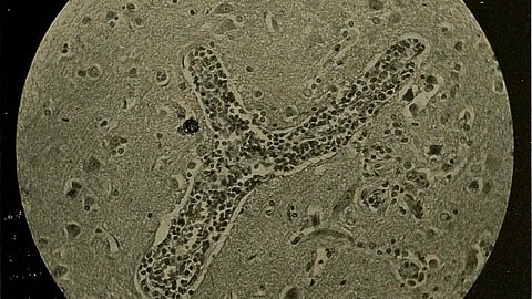 हेतुकी (Etiology) क्या है? परिभाषा , प्रकार और महत्त्व