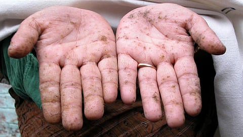 आर्सेनिक के बारे में अक्सर पूछे जाने वाले सवाल और उनके जवाब