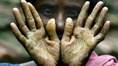 मनुष्यों में आर्सेनिक का एक्सपोजर एक मूल्यांकन,Pc-N18