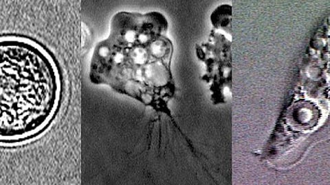 नेगलेरिया फाउलेरी, फोटो साभार - http://www.dpd.cdc.gov