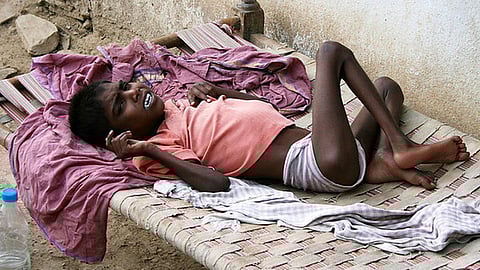फ्लोराइड : विष का अविरल प्रवाह (Fluorosis in India: An Overview)