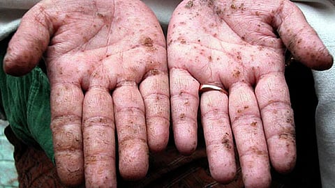 पानी बना जहर