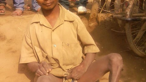 फ्लोराइड ने छीन ली कचहरिया डीह की जवानी