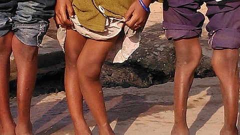 खुद ही विकलांग हुआ शेखपुरा का \"फ्लोरोसिस रोकथाम अभियान\"