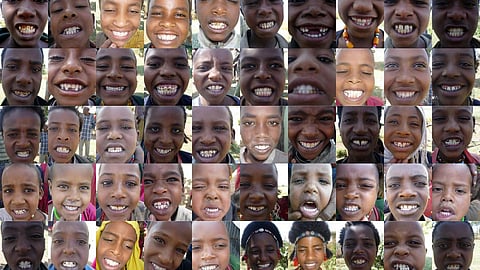 पेयजल में फ्लोराइड की अधिकता से मानव शरीर पर कुप्रभाव