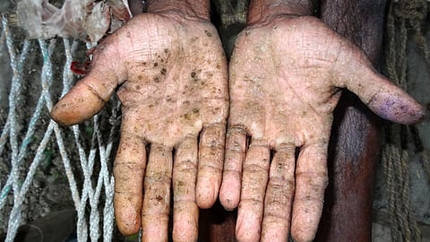 मौत बाँटता आर्सेनिक