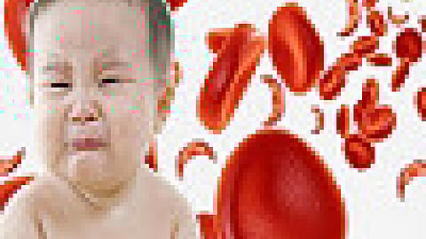 बच्चों में बढ़ती एनीमिया की समस्या