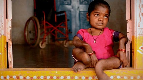 पौष्टिक आहार ही बचाएगा फ्लोरोसिस से