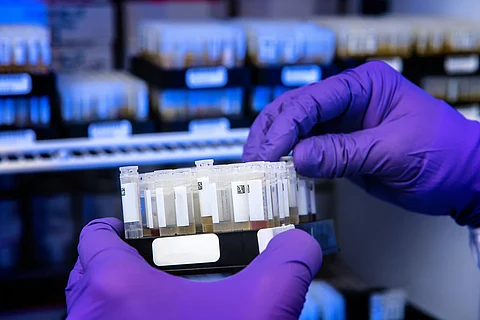 CDC to Launch Study on Potential Links Between Vaccines and Autism