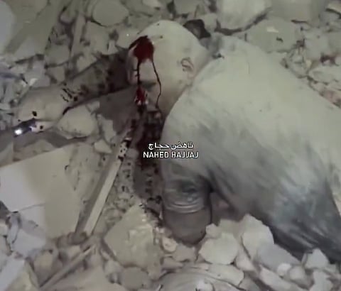 A Palestinian trapped in concrete and dust following an Israeli airstrike on June 27, 2025, in northern Gaza’s al-Samer area, where seven were killed and dozens injured.