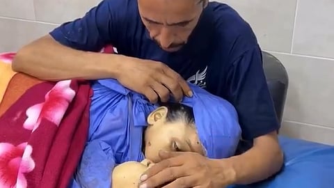 A grieving father bids farewell to his children, Waleed and Leen, killed in an Israeli airstrike that struck a vegetable stand in Al-Nuseirat camp, central Gaza.